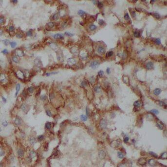 MMP28 Antibody - BSA Free