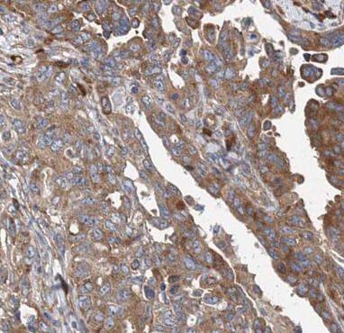 MMP23B Antibody - BSA Free