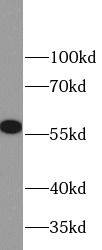 MMP23B Antibody - BSA Free