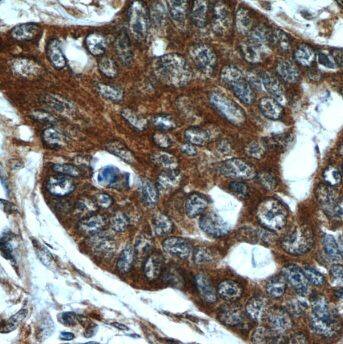 MMP21 Antibody - BSA Free