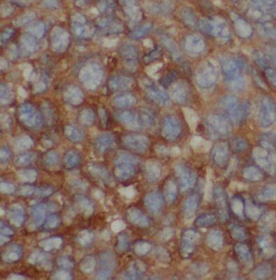 MMP20 Antibody - BSA Free