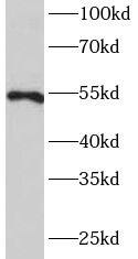 MMP20 Antibody - BSA Free