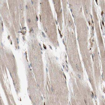 MMADHC Antibody - BSA Free