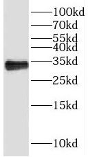 MMADHC Antibody - BSA Free
