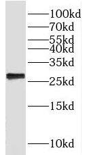 MMAB Antibody - BSA Free
