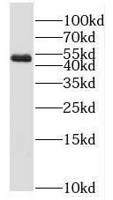 MLYCD Antibody - BSA Free
