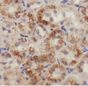 MLYCD Antibody - BSA Free