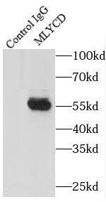MLYCD Antibody - BSA Free