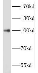 MLL5 Antibody - BSA Free