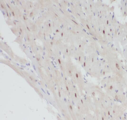 POLR2J Antibody - BSA Free