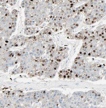 DNA Polymerase iota Antibody - BSA Free