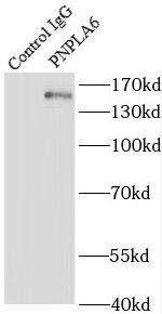 PNPLA6 Antibody - BSA Free