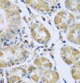 Mitochondrial-processing peptidase subunit beta Antibody - BSA Free