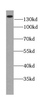 PMCA2 Antibody - BSA Free