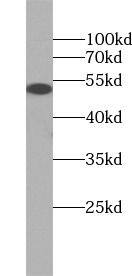 PLVAP Antibody - BSA Free