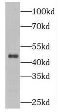 CKIP-1 Antibody - BSA Free