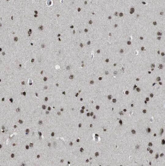 APPD Antibody - BSA Free