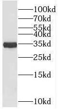 PLEKHA3 Antibody - BSA Free