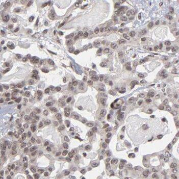 PLCD4 Antibody - BSA Free