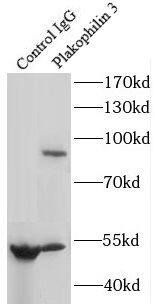 Plakophilin-3 Antibody - BSA Free