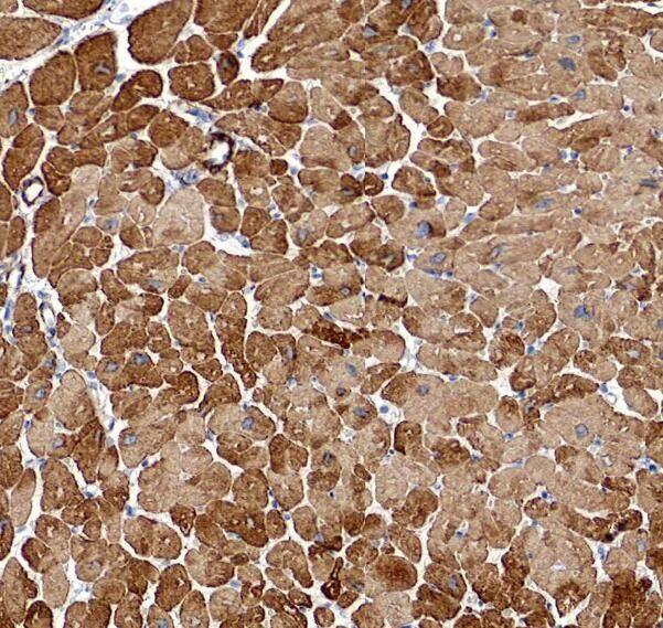 PLA2G4E Antibody - BSA Free