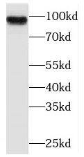 PLA2G4E Antibody - BSA Free