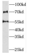 PKNOX2 Antibody - BSA Free