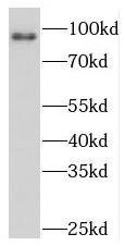 PKD2L1 Antibody - BSA Free