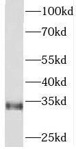 PITPN Antibody - BSA Free