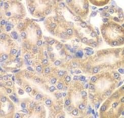 PIP5K2 alpha Antibody - BSA Free