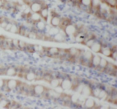 PIGZ Antibody - BSA Free