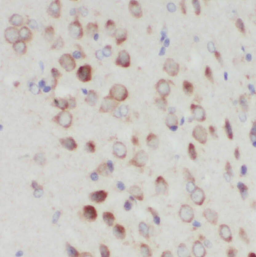 PIGT Antibody - BSA Free