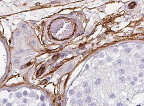 PIGM Antibody - BSA Free