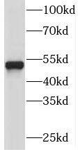 PI4K2A Antibody - BSA Free