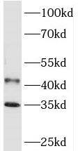PHYHIP Antibody - BSA Free