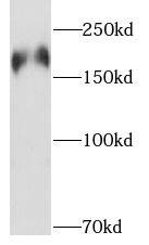 PHLPP Antibody - BSA Free
