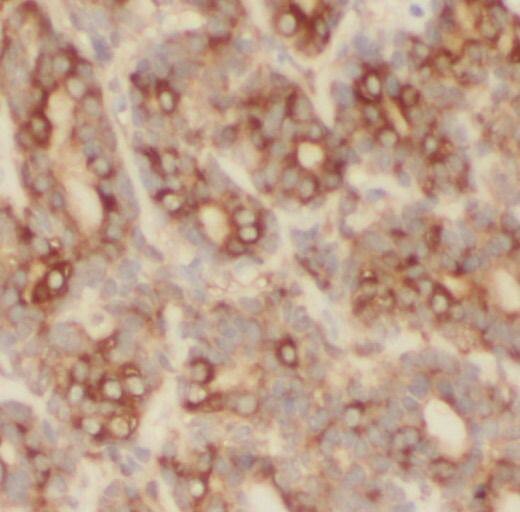 PHLPP Antibody - BSA Free