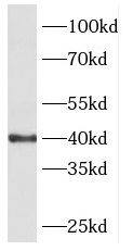 PHKG1 Antibody - BSA Free