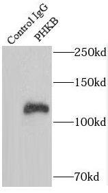 Phosphorylase B Antibody - BSA Free