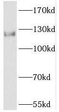 Phosphorylase B Antibody - BSA Free