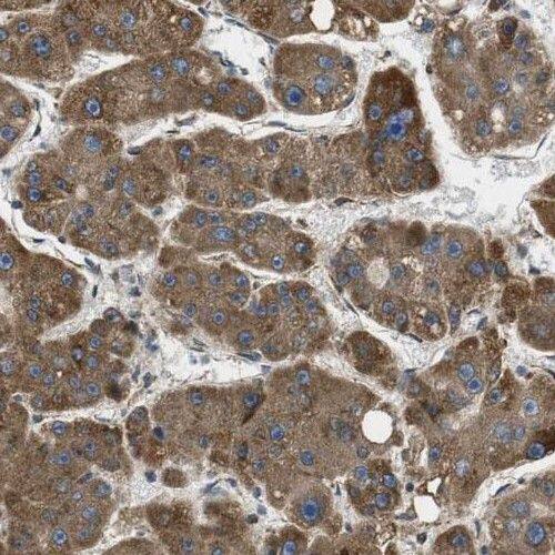 PHKA2 Antibody - BSA Free