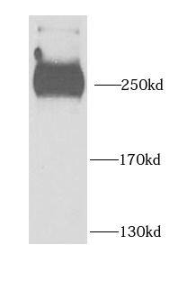 PHIP Antibody - BSA Free