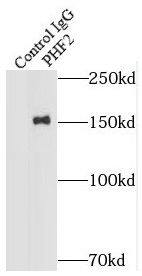 PHF2 Antibody - BSA Free