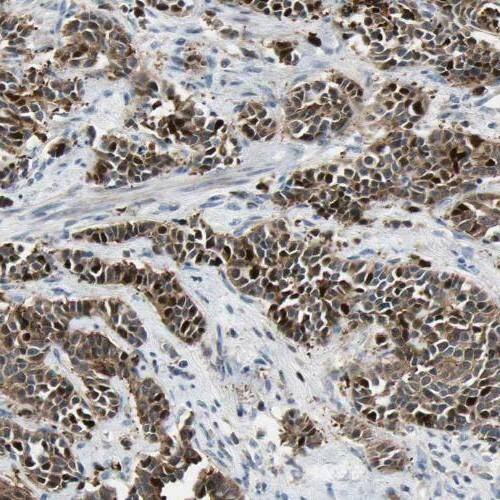 PHF2 Antibody - BSA Free