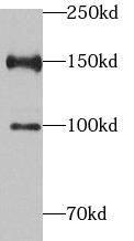 PHF2 Antibody - BSA Free