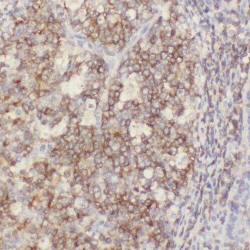 PGPase Antibody - BSA Free