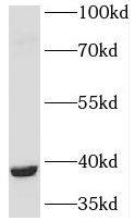 PGLYRP3/PGRPIA Antibody - BSA Free