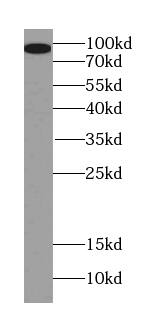 PGAP1 Antibody - BSA Free