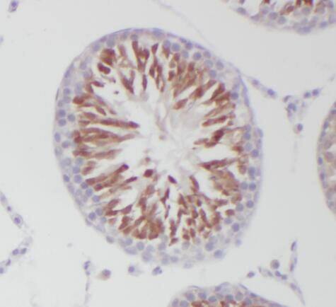 PGAP1 Antibody - BSA Free