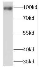 PDE6 beta Antibody - BSA Free